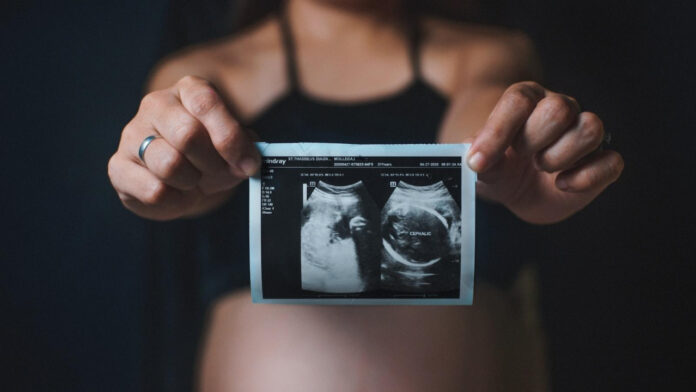 The Beauty of Maternity: Exploring Nude Pregnant Women