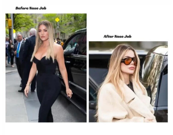 Khloe Kardashian Plastic Surgery: The Truth Revealed